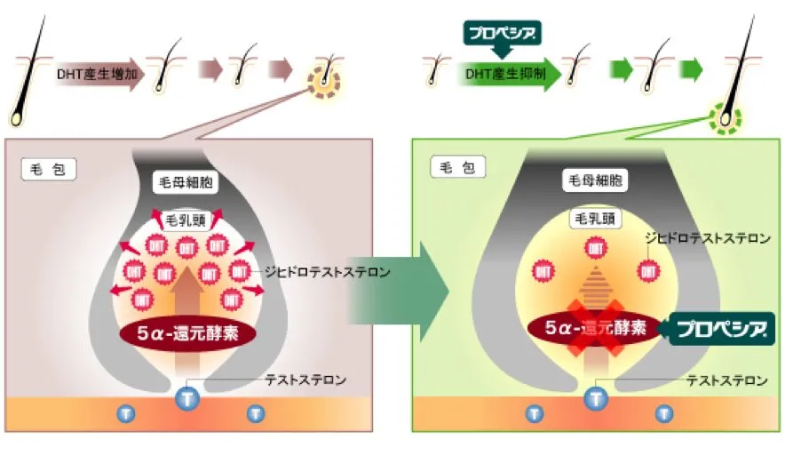 プロペシア(フィナステリド)