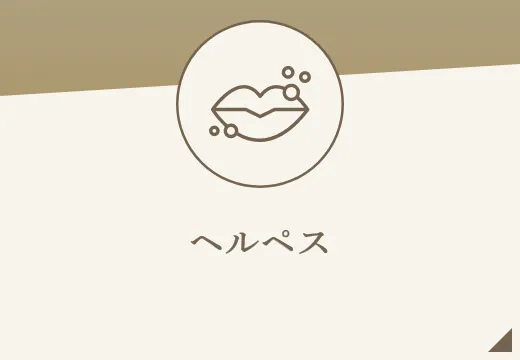ヘルペス