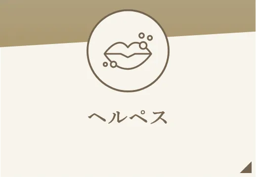ヘルペス